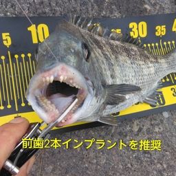 チヌ